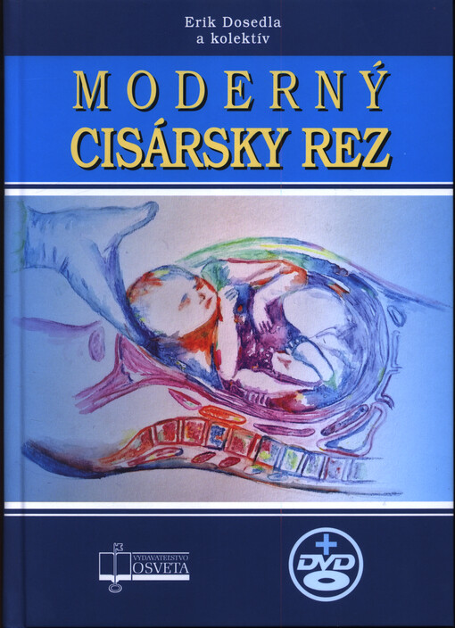 Moderný cisársky rez