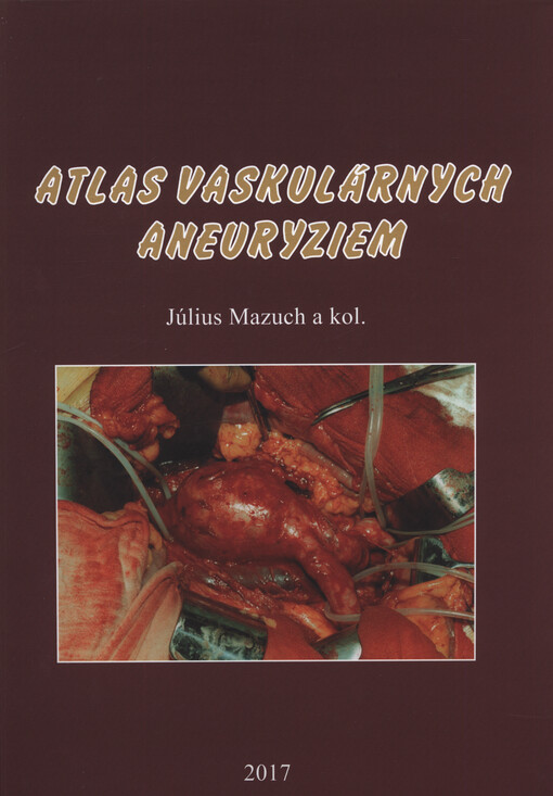 Atlas vaskulárnych aneuryziem