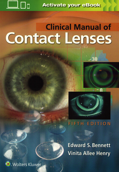 Clinical manual of contact lenses
