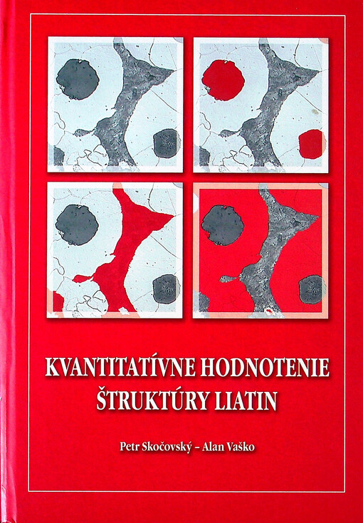 Kvantitatívne hodnotenie štruktúry liatin