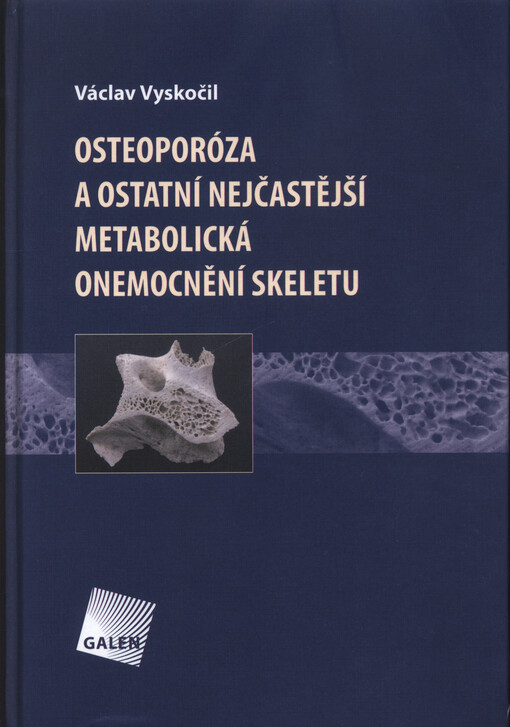 Osteoporóza a ostatní nejčastější metabolická onemocnění skeletu