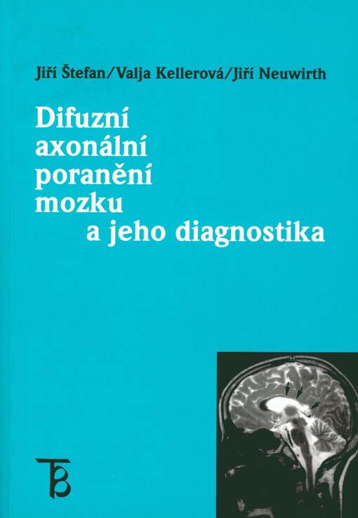 Difuzní axonální poranění mozku a jeho diagnostika