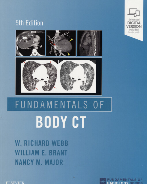 Fundamentals of body CT