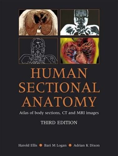 Human Sectional Anatomy: Atlas of Body Sections, CT and MRI Images