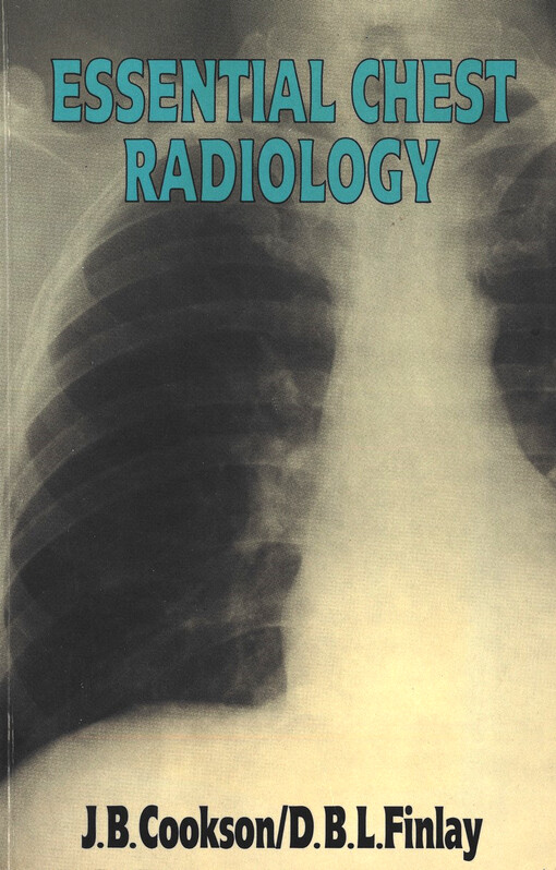 Essential chest radiology
