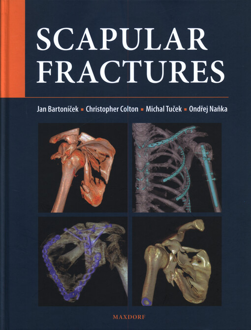 Scapular fractures