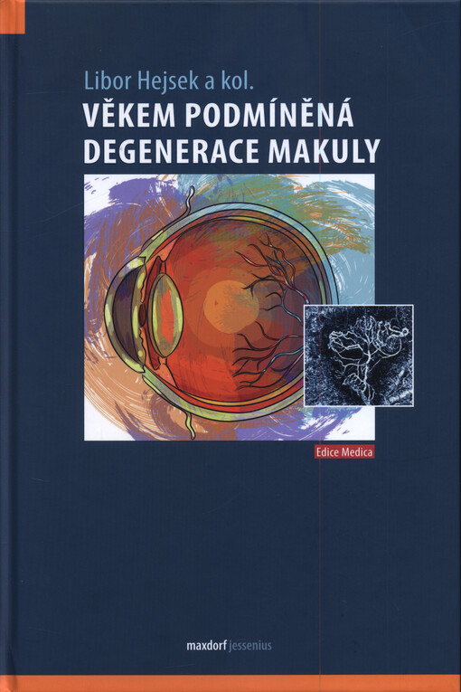 Věkem podmíněná degenerace makuly