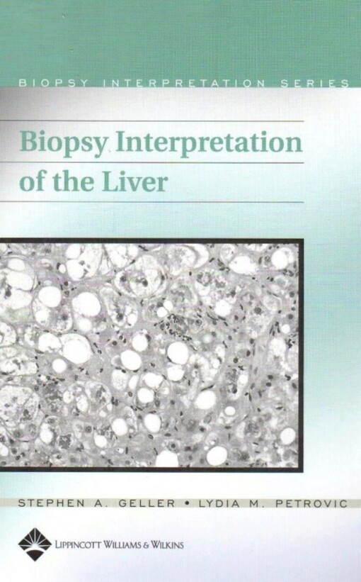 Biopsy interpretation of the liver