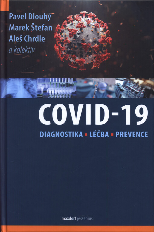 COVID-19: Diagnostika, léčba a prevence
