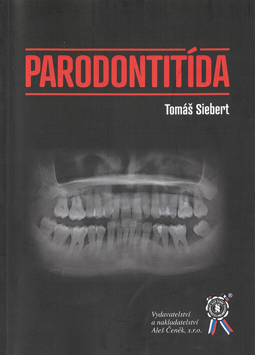 Parodontitída
