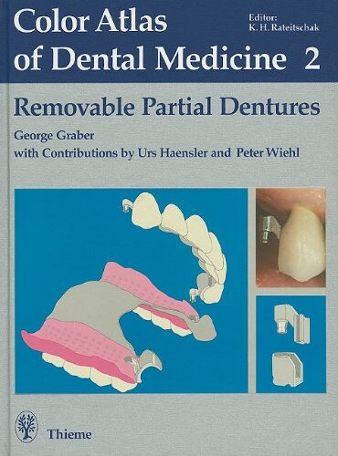 Removable Partial Dentures