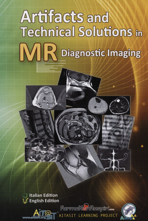 Artifacts and technical solutions in MR diagnostic imaging