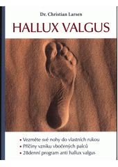 Hallux valgus  (odkaz v elektronickém katalogu)