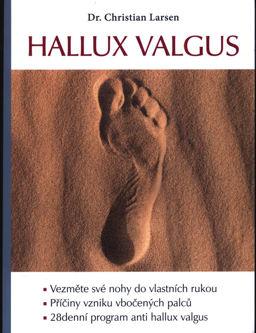 Hallux valgus