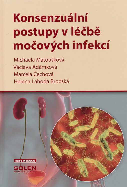 Konsenzuální postupy v léčbě močových infekcí