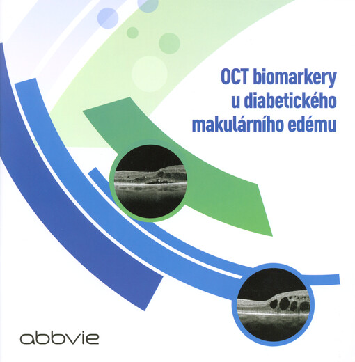 OCT biomarkery u diabetického makulárního edému
