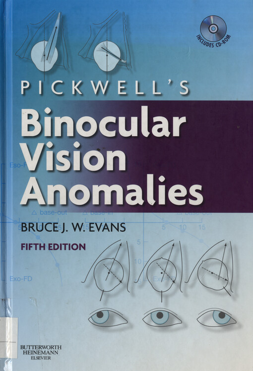 Pickwell's binocular vision anomalies