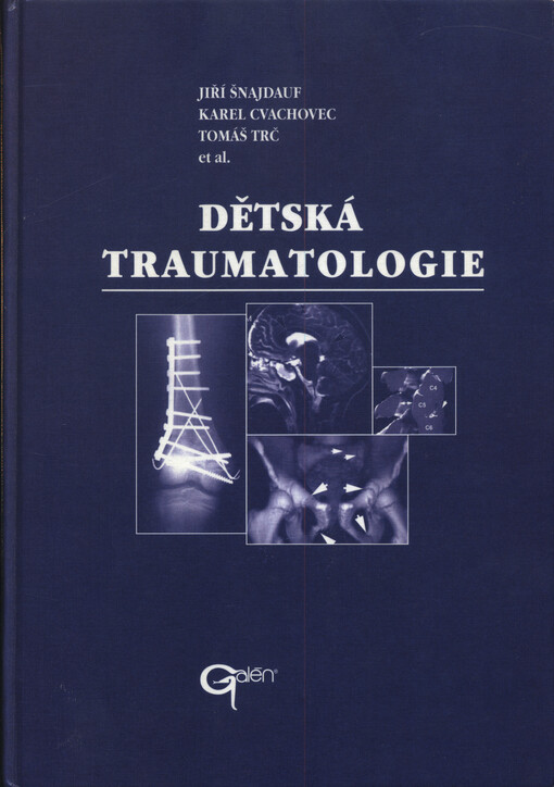 Dětská traumatologie