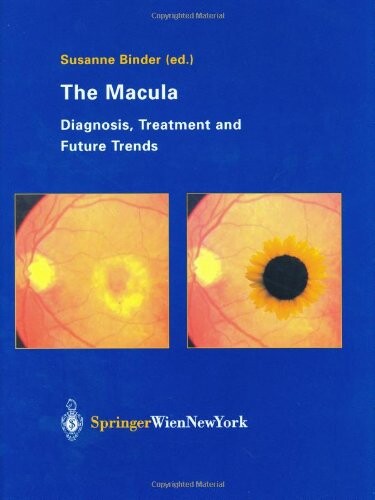 The Macula