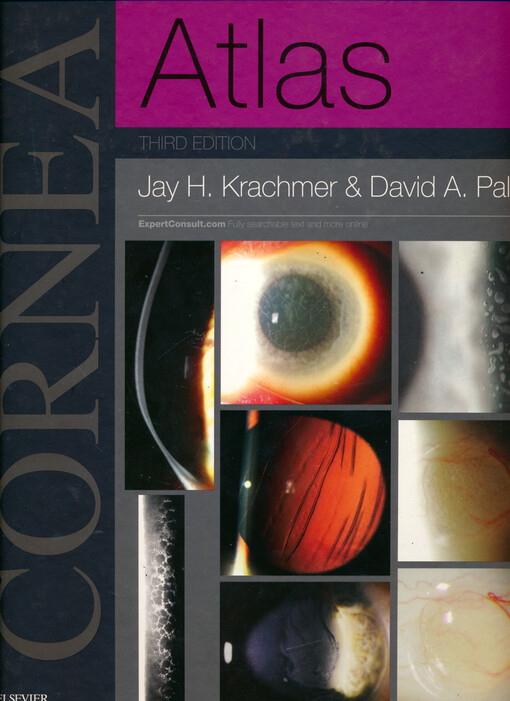 Cornea atlas