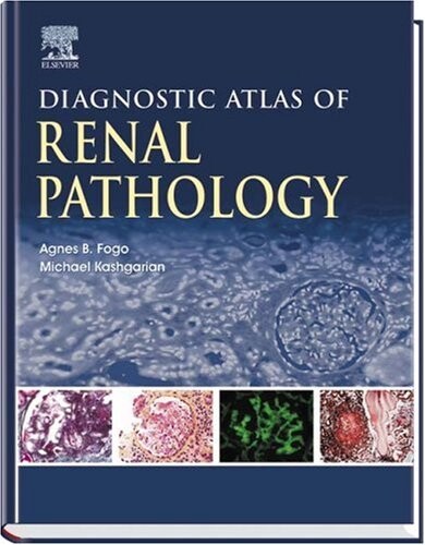 Diagnostic atlas of renal pathology