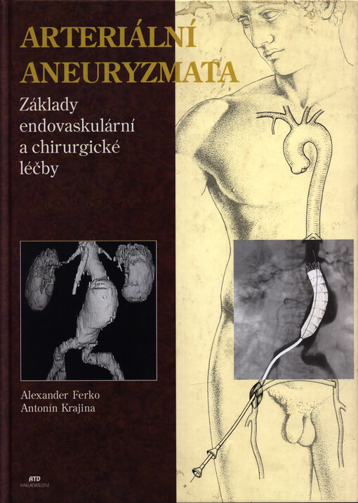 Arteriální aneuryzmata : základy endovaskulární léčby