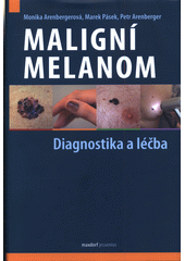 Maligní melanom : diagnostika a léčba na základě aktuálního doporučeného postupu  (odkaz v elektronickém katalogu)