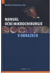 Manuál oční mikrochirurgie v obrazech  (odkaz v elektronickém katalogu)