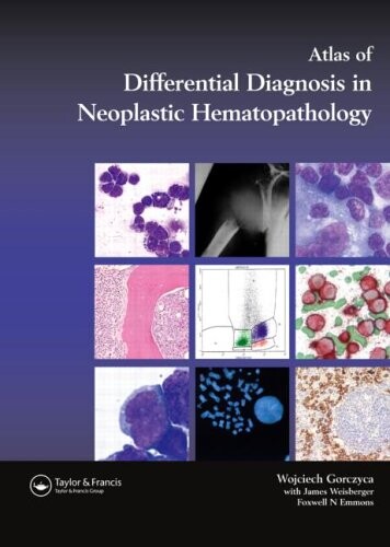 Atlas of differential diagnosis in neoplastic hematopathology