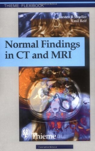 Normal findings in CT and MRI