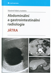 Abdominální a gastrointestinální radiologie : játra  (odkaz v elektronickém katalogu)