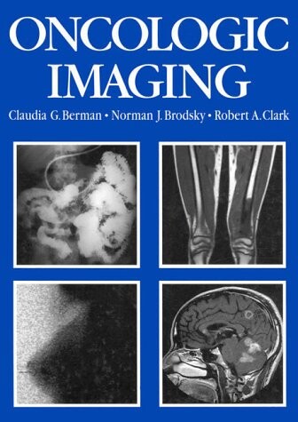 Oncologic imaging : a clinical perspective