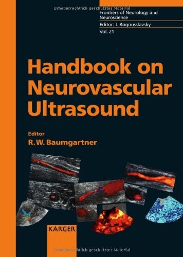 Handbook on Neurovascular Ultrasound (Frontiers of Neurology and Neuroscience)