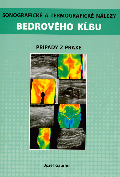 Sonografické a termografické nálezy bedrového kľbu : prípady z praxe