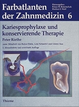 Farbatlanten der Zahnmedizin, Bd.6, Kariesprophylaxe und konservierende Therapie