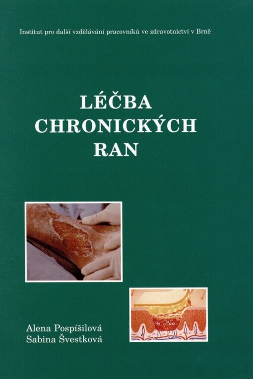 Léčba chronických ran