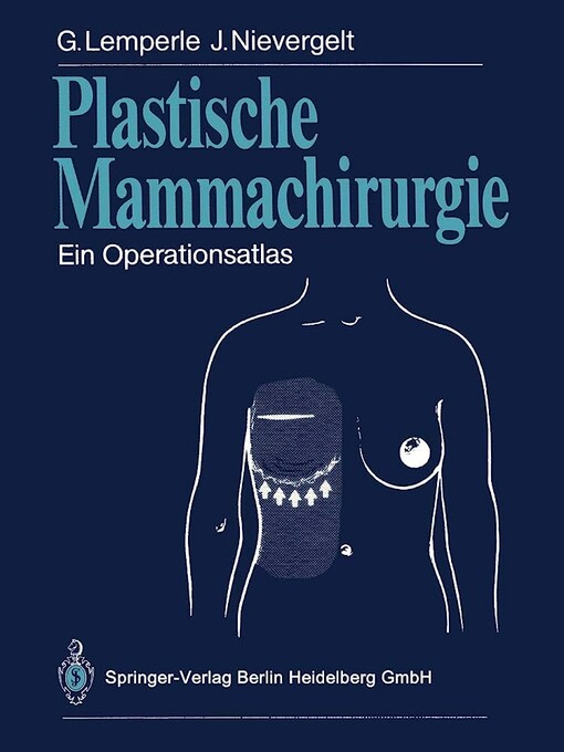 Plastische Mammachirurgie: Ein Operationsatlas (German Edition)