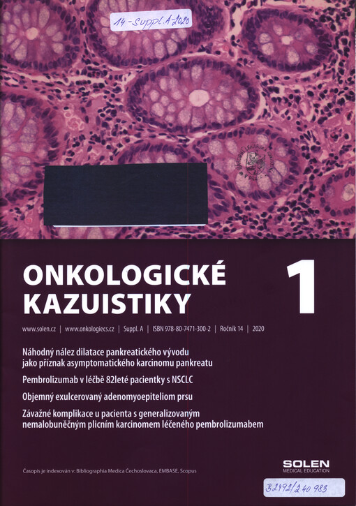 Onkologické kazuistiky