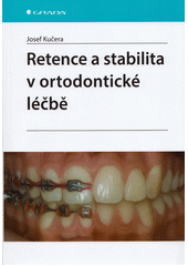 Retence a stabilita v ortodontické léčbě  (odkaz v elektronickém katalogu)