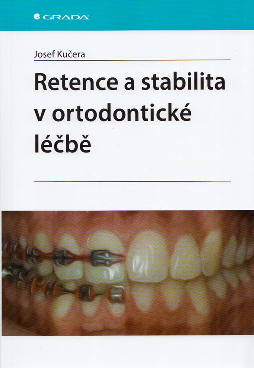 Retence a stabilita v ortodontické léčbě