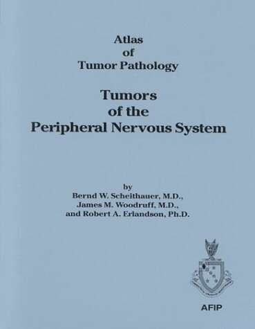 Tumors of the peripheral nervous system