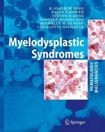 Hematologic malignancies : myelodysplastic syndromes