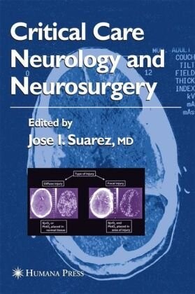 Critical Care Neurology and Neurosurgery (Current Clinical Neurology)