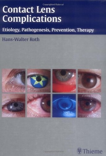 Contact Lens Complications