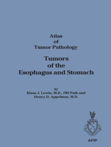 Tumors of the esophagus and stomach