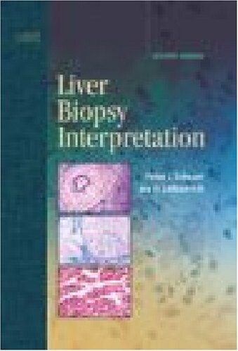 Liver Biopsy Interpretation (Major Problems in Pathology)