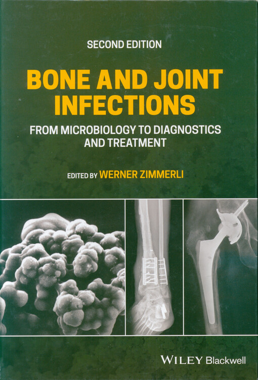 Bone and joint infections : from microbiology to diagnostics and treatment