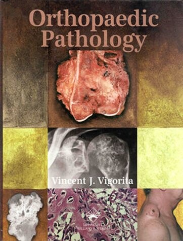 Orthopaedic pathology