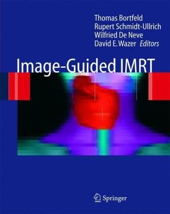 Image-Guided IMRT