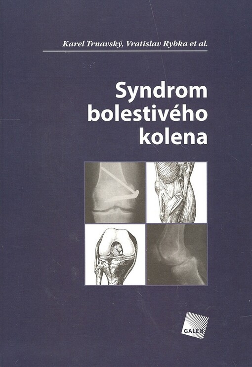 Syndrom bolestivého kolena